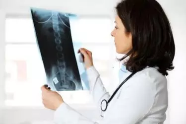 best hospital for multiple sclerosis treatment in purnia, best doctor for multiple sclerosis treatment in purnia, cost of multiple sclerosis treatment in purnia