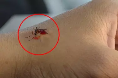 best hospital for dengue treatment in Purnia, best doctor for dengue treatment in Purnia, cost of dengue treatment in Purnianiya.webp