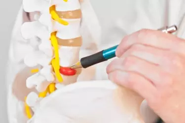 best hospital for spine surgery in purnia, best doctor for back pain treatment in purnia, cost of spine surgery in purnia